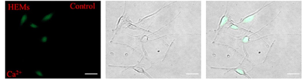 HEMs from children's foreskin loaded with the Ca2+ indicator Fluo-3.