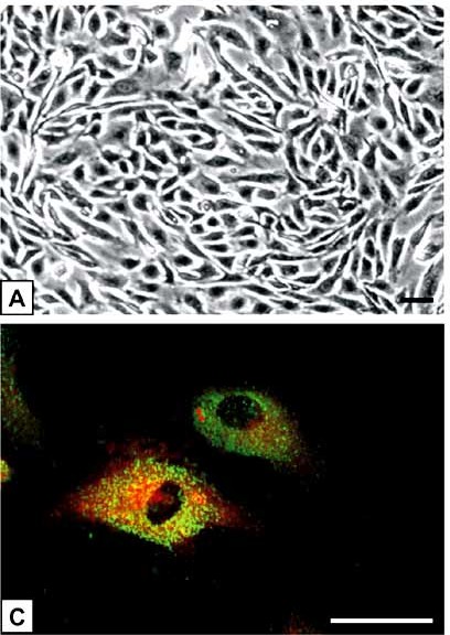 (A) HPAECs, which are polygonal in shape, tend to grow in loosely organized patterns and display a characteristic cobblestone appearance when reaching confluence. (C) Double-fluorescence staining revealed that HPAECs showed a bright, uniform fluorescence with UEA-I lectin (red), in contrast to the granular fluorescence observed with the von Willebrand factor antibody (green).