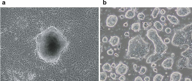 Derivation of mouse fibroblast-derived induced pluripotent stem cells (iPSCs).