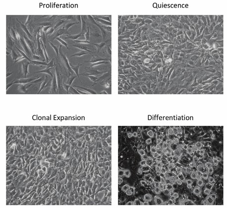 A schematic illustration of the differentiation process of 3T3-L1 adipocytes.