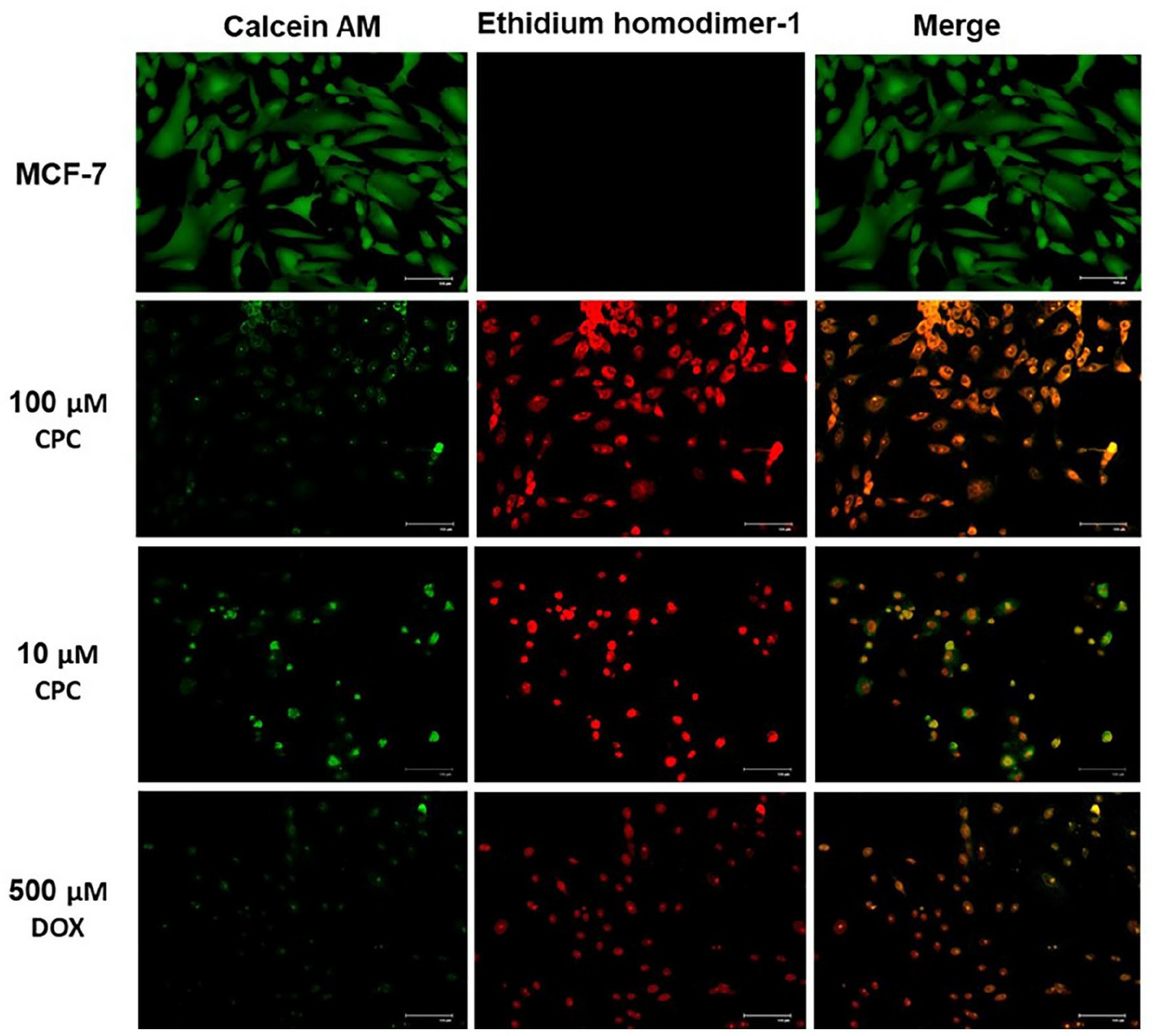Cell survival and morphology of MCF-7 were determined by LIVE/DEAD test and FLM after a 24 h-exposition to 10 and 100 µM CPC or 500 µM DOX (inhibition control).