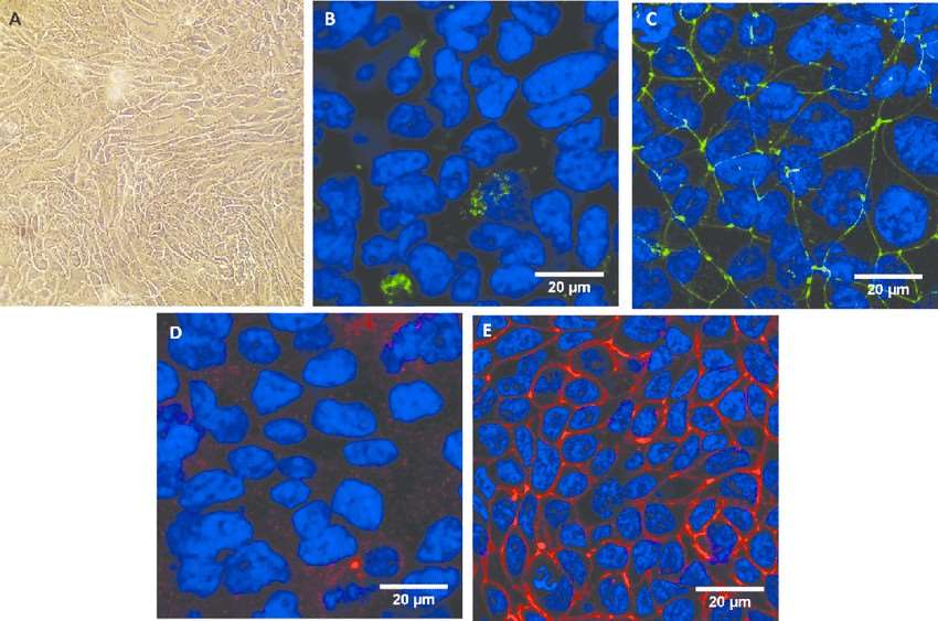 Calu-3 cell morphological characterization.