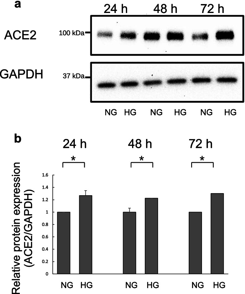 a The cells were treated with normal D-glucose (NG) or high D-glucose (HG) for 24, 48, and 72 h. Whole-cell lysates were collected and subjected to western blotting for ACE2 and glyceraldehyde-3-phosphate dehydrogenase (GAPDH). b The bar graph was generated by quantifying western blots from three independent experiments.