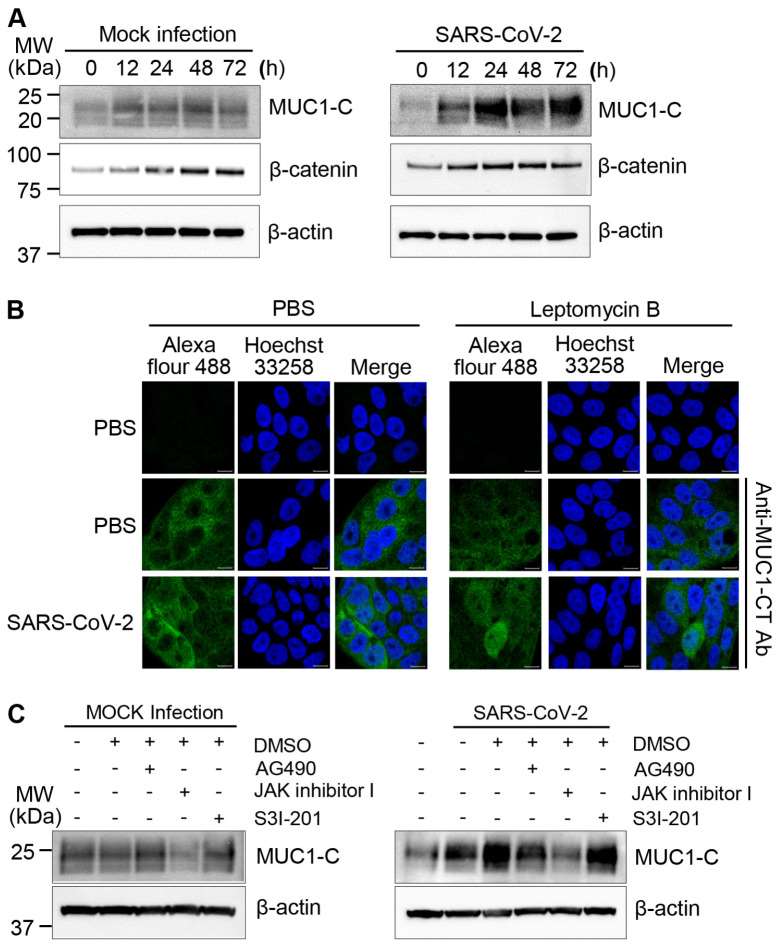 (A) Calu-3 cells were mock-infected as a control or infected with SARS-CoV-2 at a MOI of 0.5 for the indicated periods. Cell lysates were prepared, and western blotting was performed with the indicated antibodies. (B) Calu-3 cells were mock-infected or infected with SARS-CoV-2 at a MOI of 0.5. After 1 h of incubation, the viral medium was replaced with DMEM containing 2% FBS. After 45 h of incubation, the cells were treated with PBS or 20 nM Leptomycin B for 3 h. (C) Calu-3 cells were pretreated with 0.1% DMSO, 25 μM AG490, 1 μM JAK inhibitor I, or 20 μM S3I-201 for 30 min. The cells were washed with PBS, and then mock-infected or infected with SARS-CoV-2 in PBS at a MOI of 0.5. Cell lysates were prepared at 48 h and analyzed by western blotting.