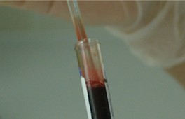 Plasma Stability Assay