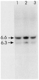 Southern blot analysis of EcoRI-digested DNA extracted from normal human lymphocytes (lanes 1) and GP2d and GP5d (lanes 2 and 3) and hybridized with a ret cDNA probe.