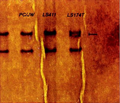 Single-strand conformational polymorphism (SSCP) analysis of exon 3 of E-cadherin, showing the heterozygous band mobility of LS174T (arrow). Sequencing showed this to be a single base pair deletion causing a premature stop at codon 216.