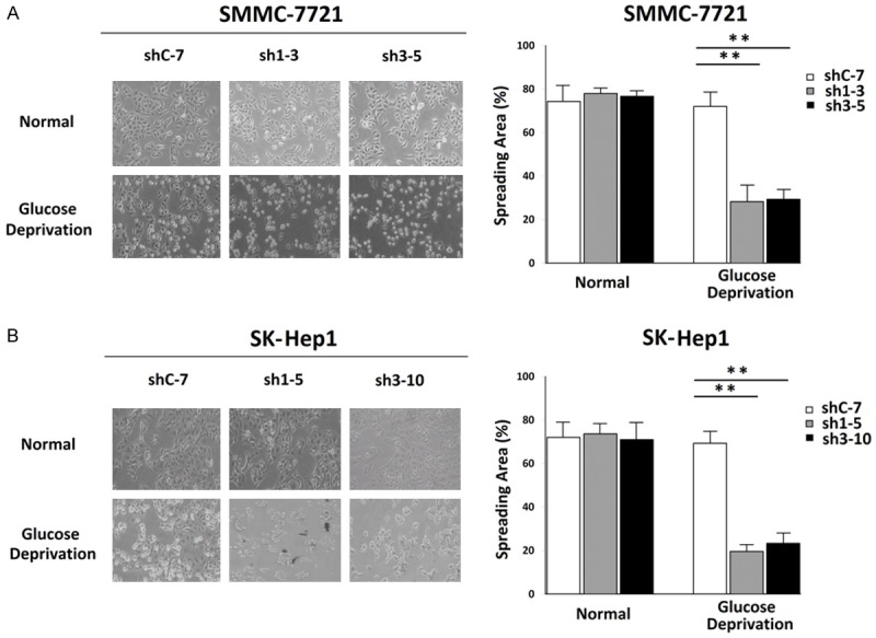 A. Effect of HRP-3 Knockdown on SMMC-7721 cell survival ability under glucose deprivation, as analyzed by morphology observation. B. Effect of HRP-3 Knockdown on SK-Hep1 cell survival ability under glucose deprivation, as analyzed by morphology observation.