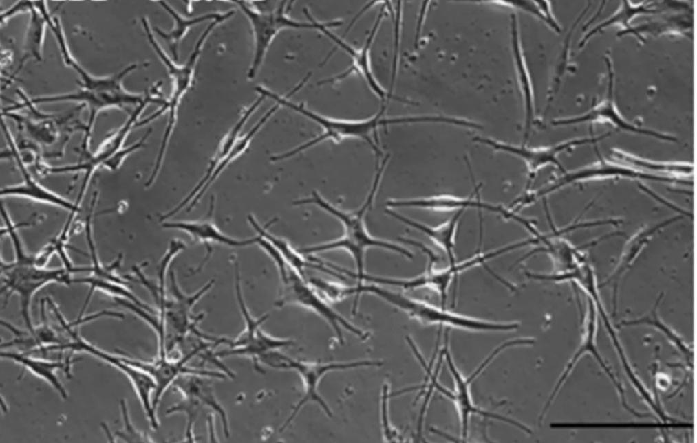 Darkly human primary epidermal melanocytes.