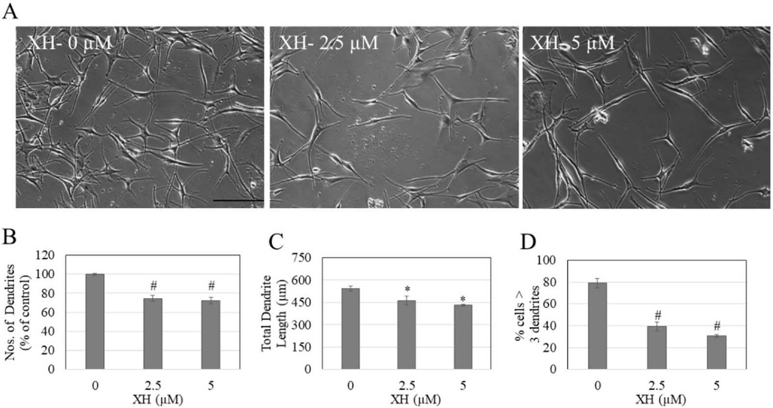 Analysis of HEM-DP cell structure and dendricity assessment.