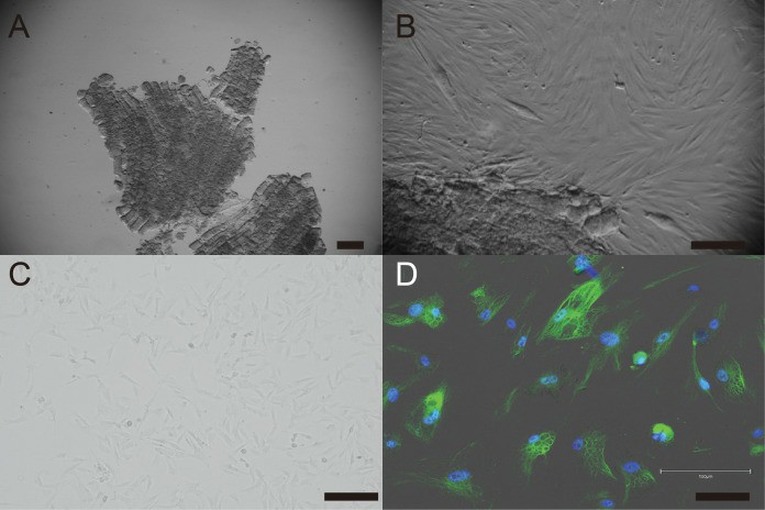 (A) Muscle fragments sample. (B) Fibroblasts-like cells spread from muscle explant. (C) A typical spindle-shaped fibroblast in passage 5. (D) Immunostaining showed green for vimentin and blue for nuclei.