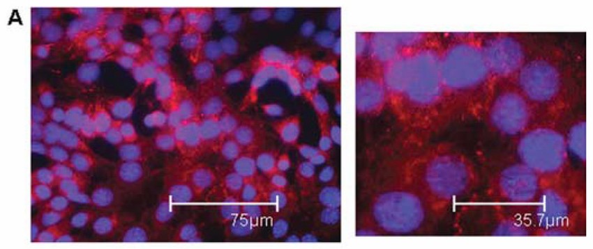 MLE-15 cells cultured in standard cell culture conditions.