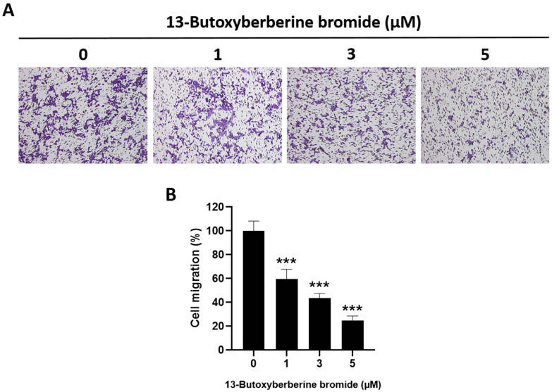 Inhibitory effect of 13-butoxy berberine bromide on cell migration in A431 cells.