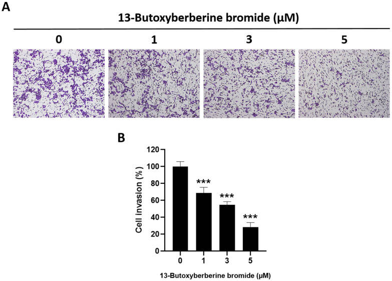 Cytoskeleton structure in musculoskeletal cancer lines and healthy cells.