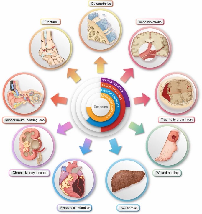 Fig. 2 Illustration of the downstream surgical applications of exosome therapy.