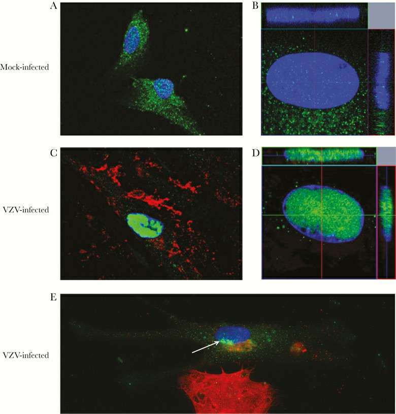 Localization of the neurokinin-1 receptor in both mock-infected and varicella zoster virus (VZV)–infected primary human spinal astrocytes, as detected by immunofluorescence antibody assays (IFA).