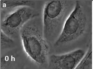 Microscopic picture of undifferentiated neonatal human epidermal keratinocytes.