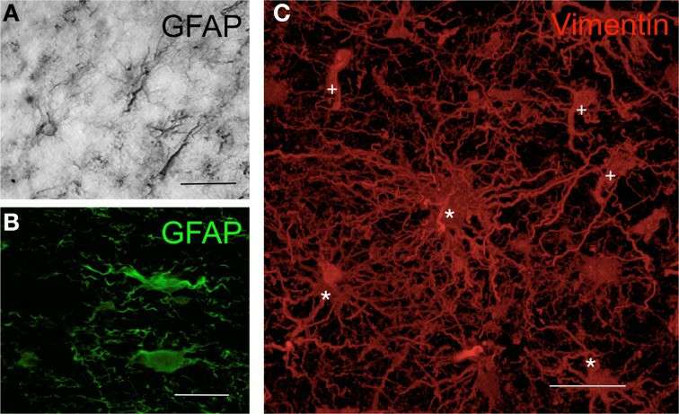 The morphology of human astrocytes studied by immunohistochemistry techniques.