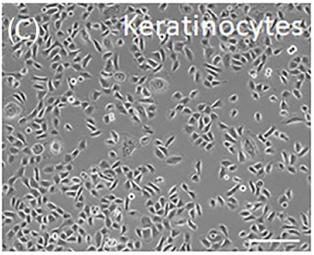 Microscopic pictures of human fetal epidermal keratinocytes.