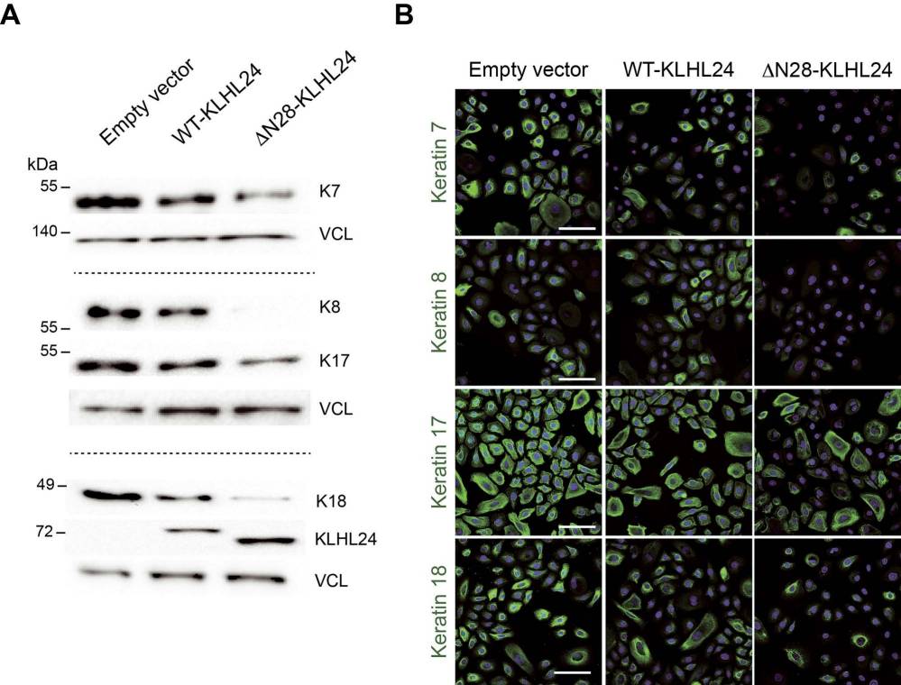 The levels of foetal keratin proteins significantly decrease in primary foetal keratinocytes transduced with the mutant form of KLHL24.