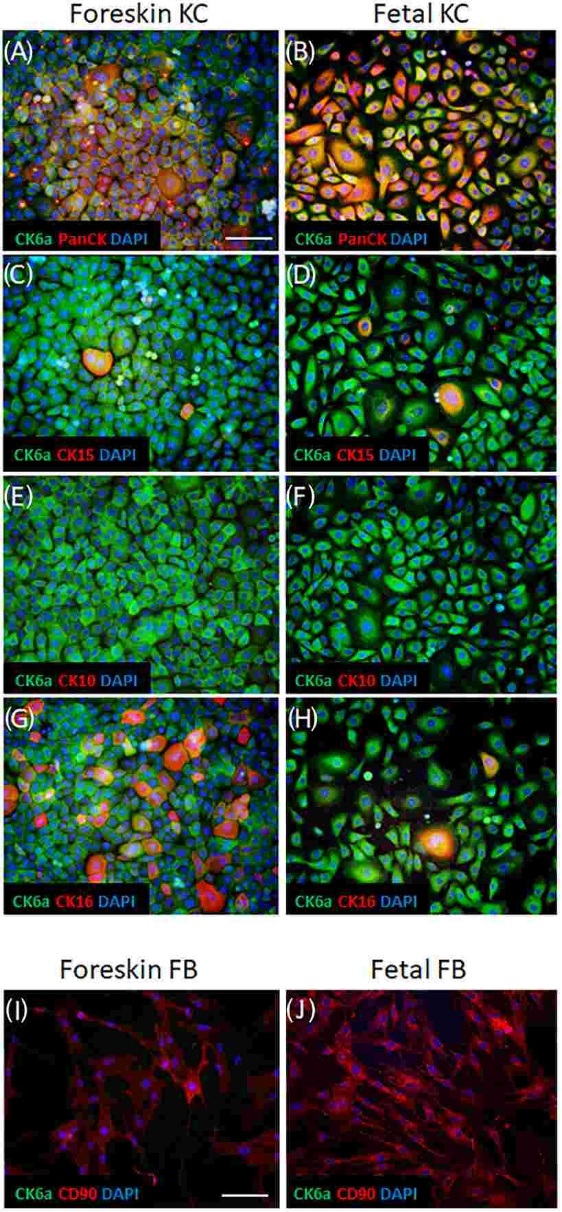 The expression pattern of CK6a in vitro in cultured keratinocytes.