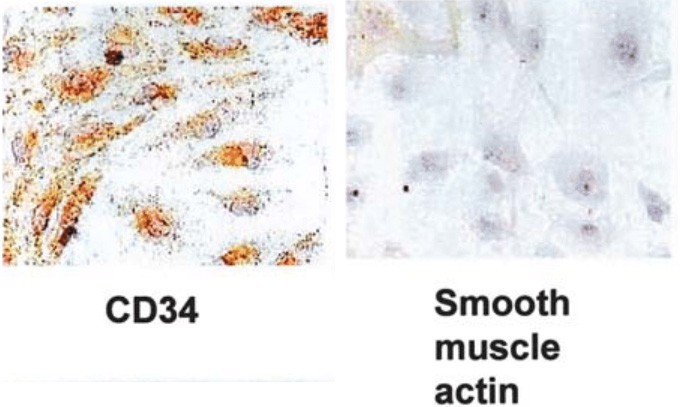 Characterization of human uterine microvascular endothelial cells in culture.