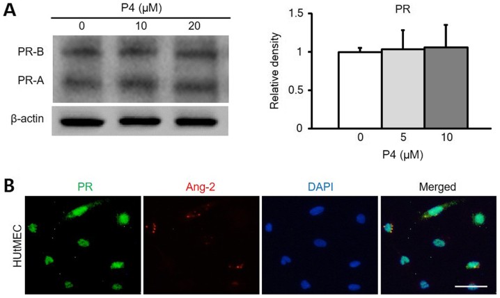 Ang-2 expression is linked to PR in HUtMECs.