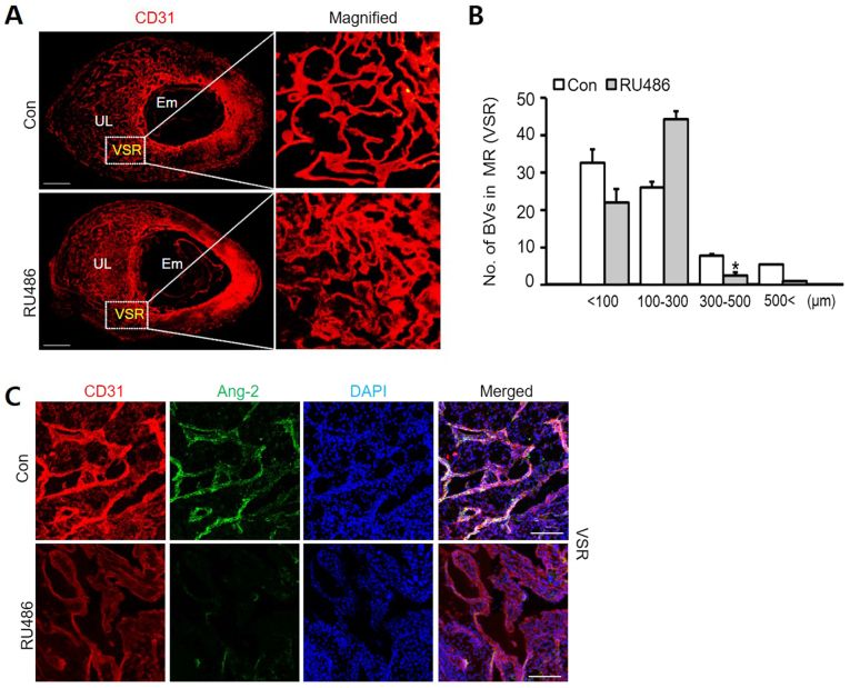 RU486 reduces vascular remodeling in the VSR.