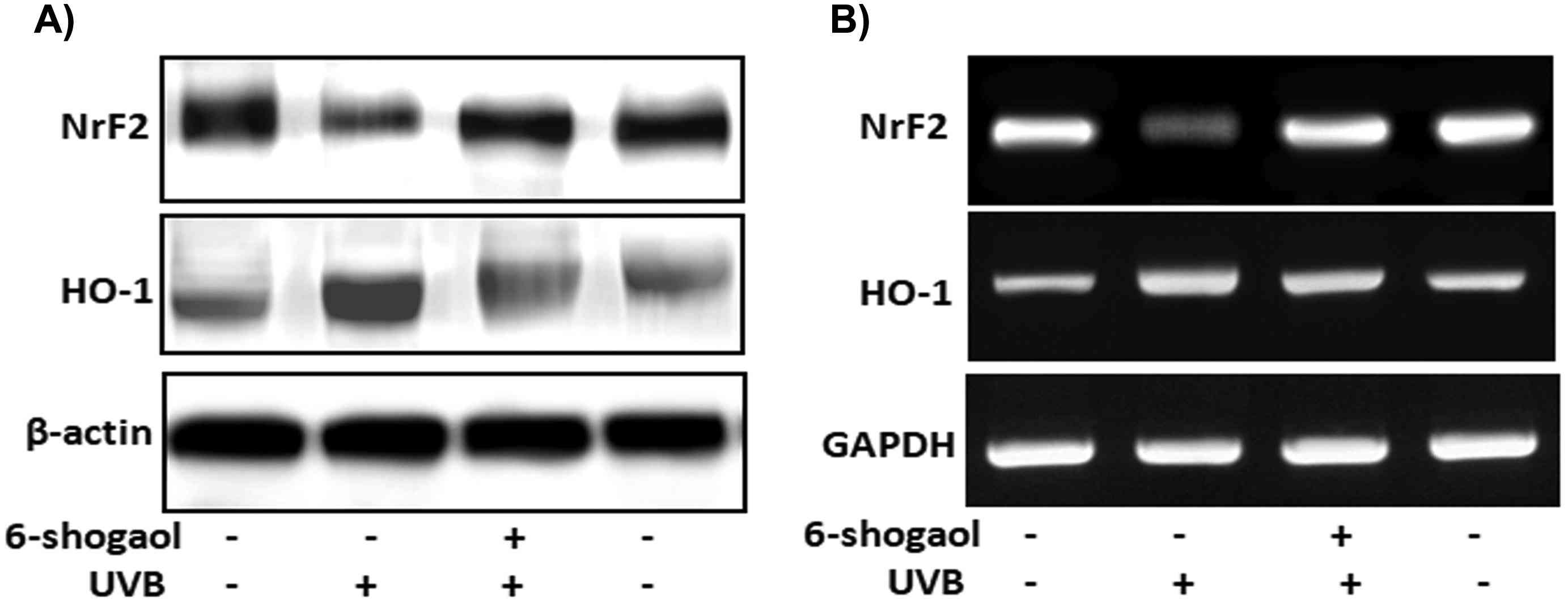 6-Shogaol influences NrF2 signaling in human epidermal keratinocytes subjected to UVB exposure.