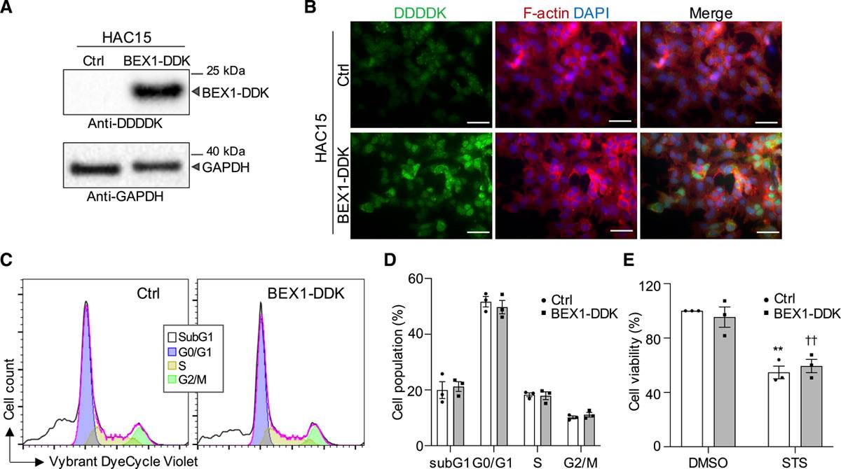 BEX1 does not influence the progression of the cell cycle or apoptosis in adrenocortical cells.