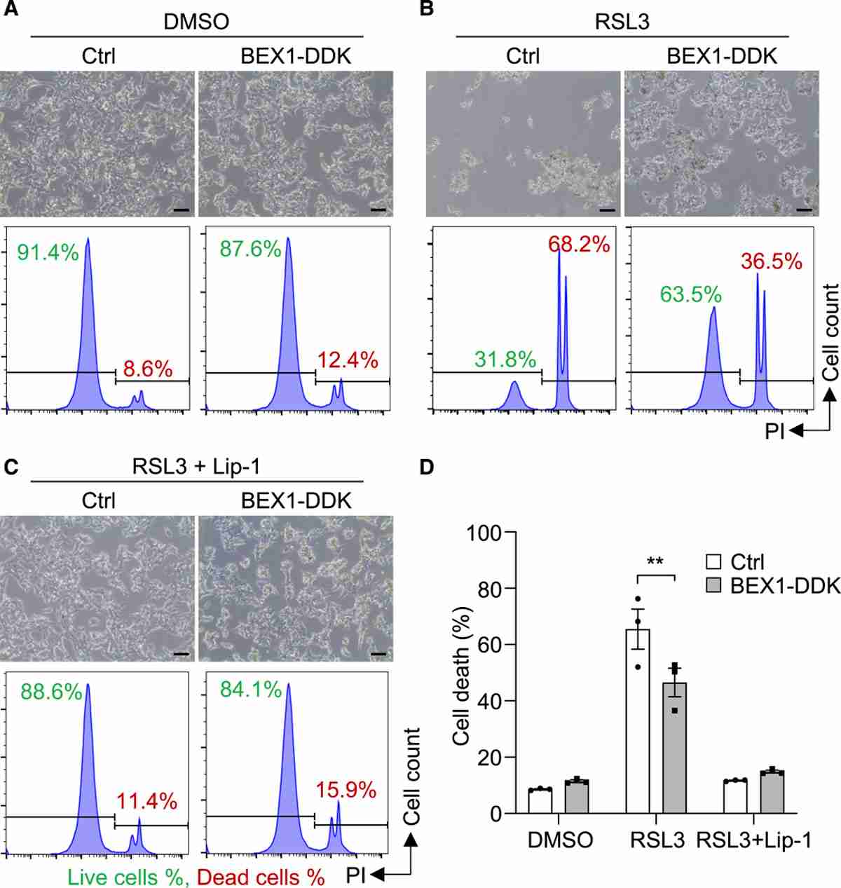 BEX1 acts to prevent cell death through the inhibition of ferroptosis in these cells.