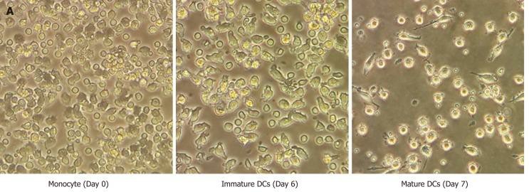 Human monocyte-derived dendritic cells morphology.