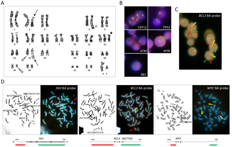 (A) G-banding karyotype. t(14;19)(q32;q13) and t(2;14)(p13;q32) are indicated by open arrowheads and arrows, respectively. (B) Interphase FISH using the CLL FISH panel. (C) Interphase FISH using the BCL3 BA probe. (D) Metaphase FISH using the IGH BA probe (left), BCL3 BA probe (middle), and MYC BA probe (right).