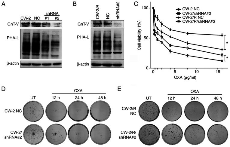 (A) and (B) shRNA mediated GnT-V knockdown and β-1,6-oligosaccharide reduction in (A) CW-2 and (B) CW-2/R cells as depicted by western blotting and lectin blotting, respectively, compared with the respective parental cell lines and NC cells. (C) Cells were exposed to indicated concentrations of oxaliplatin (0.25-16 µg/ml) for 48 h, and cell viabilities were determined by Cell Counting Kit-8 assay. Representative images of (D) wild-type and (E) drug-resistant cells showing that oxaliplatin-treated GnT-V knockdown cells had reduced chemosensitivity, resulting in an increased colony-forming potential compared with NC cells.