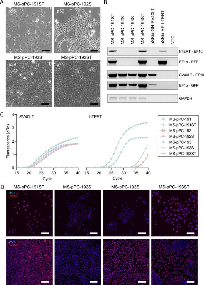 A Established immortalized cell lines at high passage numbers. B Genomic integration of immortalization displayed by PCR on gDNA of immortalized cell lines. C Expression of immortalization factors on mRNA level. D Expression of immortalization factors on protein level.