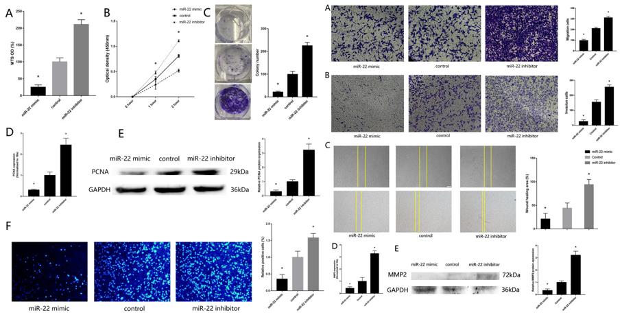 Left: (A) MTS assay detected the proliferation of MG63 transfected with miR-22 mimic and inhibitor. (B) CCK-8 assay. (C) Colony formation assay. (D) RT-qPCR detected the expression of PCNA. (E) Western blotting detected the expression of PCNA. (F) EdU assays. Right: (A) Transwell migration assay detected the migration of MG63 transfected with miR-22 mimic and inhibitor. (B) Transwell invasion assay detected the invasion of MG63 transfected with miR-22 mimic and inhibitor. (C) Wound healing assay. (D) RT-qPCR detected the expression of MMP2. (E) Western blotting detected the expression of MMP2.