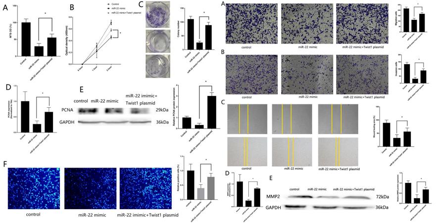 Left: (A) MTS assay detected the proliferation of MG63 transfected with both miR-22 mimic and Twist1 vector. (B) CCK-8 assay. (C) colony formation assay. (D) RT-qPCR detected the expression of PCNA. (E) Western blotting detected the expression of PCNA. (F) EdU assays. Right: (A) Transwell migration assay detected the migration of MG63 transfected with both miR-22 mimic and Twist1 vector. (B) Transwell invasion assay detected the invasion of MG63 transfected with both miR-22 mimic and Twist1 vector. (C) Wound healing assay. (D) RT-qPCR detected the expression of MMP2. (E) Western blotting detected the expression of MMP2.