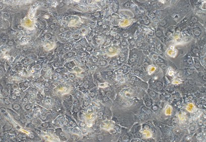 Primary human hepatocytes.