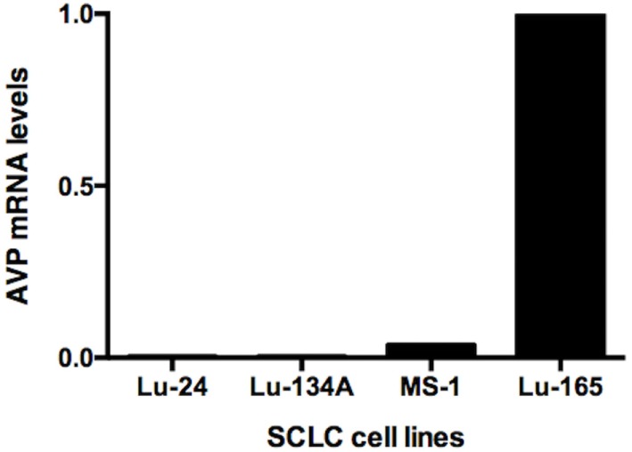 Comparison of AVP mRNA levels among the four SCLC cell lines.