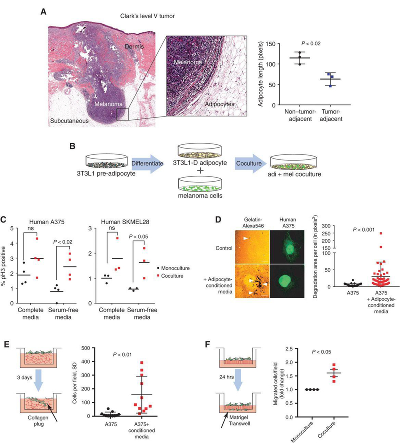 (A) H&E staining on a Clark’s Level V tumor. (B) Schematic showing the adipocyte-melanoma coculture system. (C) Phosho-H3 staining in SKMel28-GFP and A375-GFP cells co-cultured with 3T3L1 adipocytes for 24 hours. (D) Gelatin degradation assay to measure the invasive capacity of A375-GFP cells. A375-GFP cells were seeded on a gelatin matrix and grown in control media or adipocyte-conditioned media for 24 hours. (E) A375-GFP were seeded on top of the collagen-polymerized matrix and allowed to invade for 3 days. (F) Matrigel transwell migration of FACS-isolated A375-GFP cells in monoculture or after co-culture with 3T3L1 adipocytes for 7 days.