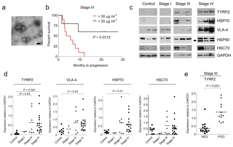 (a) Representative electron microscopic image of exosomes derived from the plasma of a melanoma subject. (b) Kaplan-Meier survival curve showing cumulative probabilities in Stage IV subjects over 42 months of follow-up according to total protein (micrograms) in isolated circulating exosomes per milliliter of plasma analyzed. (c) Representative Western blot of TYRP2, VLA-4, HSP70, HSP90, and HSC70 proteins in circulating exosomes isolated from the plasma of melanoma subjects (Stages I, III, and IV) and healthy controls. (d) Statistical analysis of western blot densitometry of signature proteins in circulating exosomes relative to GAPDH. (e) Statistical analysis of western blot densitometry for TYRP2 expression in circulating exosomes relative to GAPDH in a retrospective series of frozen plasma derived from stage III melanoma subjects.