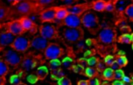 Cell Proliferation Assay Kit