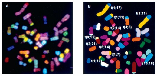 Abnormal chromosomes and their identification of OCI-Ly17 cell line are indicated in the classification image.