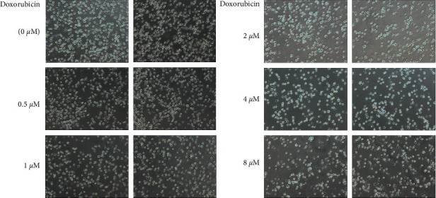 Images of doxorubicin affecting OCI-LY1 cell proliferation (100x).