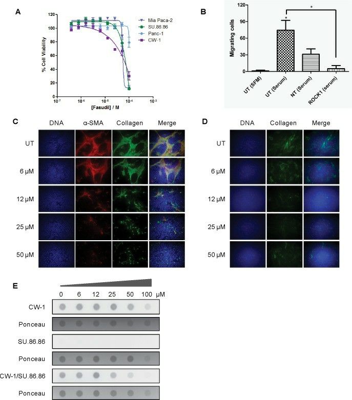 A) Fasudil dose-response curves in pancreatic cancer cells treated for 72 hours. B) Tumor cell migration in ROCK1 siRNA treated cells. C) Fluorescence microscopic analysis of fasudil-treated, co-cultured pancreatic cancer cells and cancer-associated fibroblasts. Cells were treated with fasudil for 48 hours and then were stained for α-SMA (red), Collagen I (green), and DNA (blue). D) Fluorescence microscopic analysis of fasudil-treated CAFs. E) Fasudil-treated, mono- and co-cultured pancreatic cancer cells and cancer-associated fibroblasts were harvested and analyzed by immunoblotting (dot blot) for Collagen I expression under non-denaturing conditions.