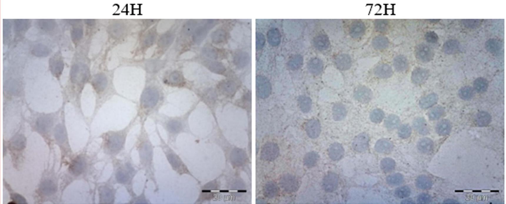 Microscopic observations of SNB-19 cells following 24 and 72 hours of culture.