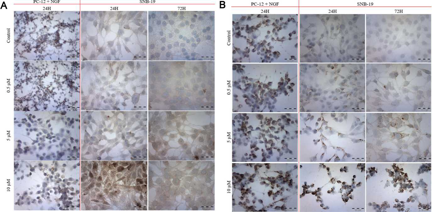 The changes of calcium T-type channel (A) and VDAC (B) were detected by immunocytochemistry ABC method after 24 and 72 h of CEP treatment.