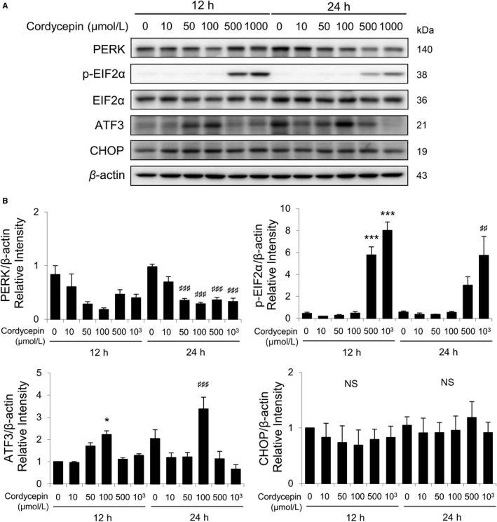 Cordycepin-induced apoptosis of MA-10 cells by activating PERK/EIF2a signaling pathways.