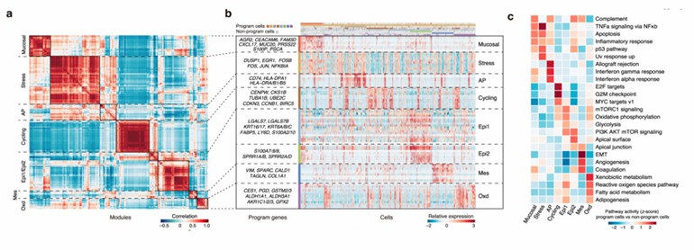 (a) Heatmap showing pairwise correlations of 274 modules derived from 52 tumors. The common expression programs across tumors are aggregated into clusters. (b) Heatmap showing expression of genes within each program across single cells.  (c) Heatmap showing differences in pathway activities between program cells and non-program cells for each program scored by GSVA.