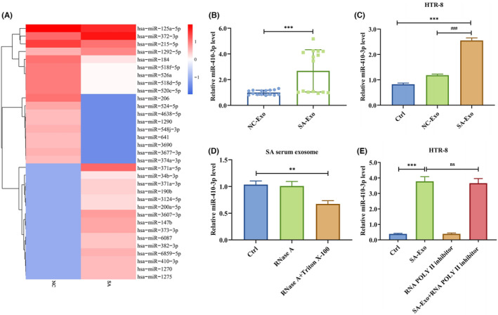 (A) The heatmap showed the relative expression of miRNAs in NC and SA serum exosomes. (B) The expression level of miR-410-3p in NC and SA serum exosomes was measured by RT-PCR. (C) The expression level of miR-410-3p in HTR-8 cells treated with NC or SA serum exosomes was detected by RT-PCR. (D) The expression level of miR-410-3p in SA serum exosomes treated with RNase A alone or in combination with Triton X-100 was detected by RT-PCR. (E) The expression level of miR-410-3p in HTR-8 cells treated with polymerase II inhibitors and then incubated with SA serum exosomes was monitored by RT-PCR.